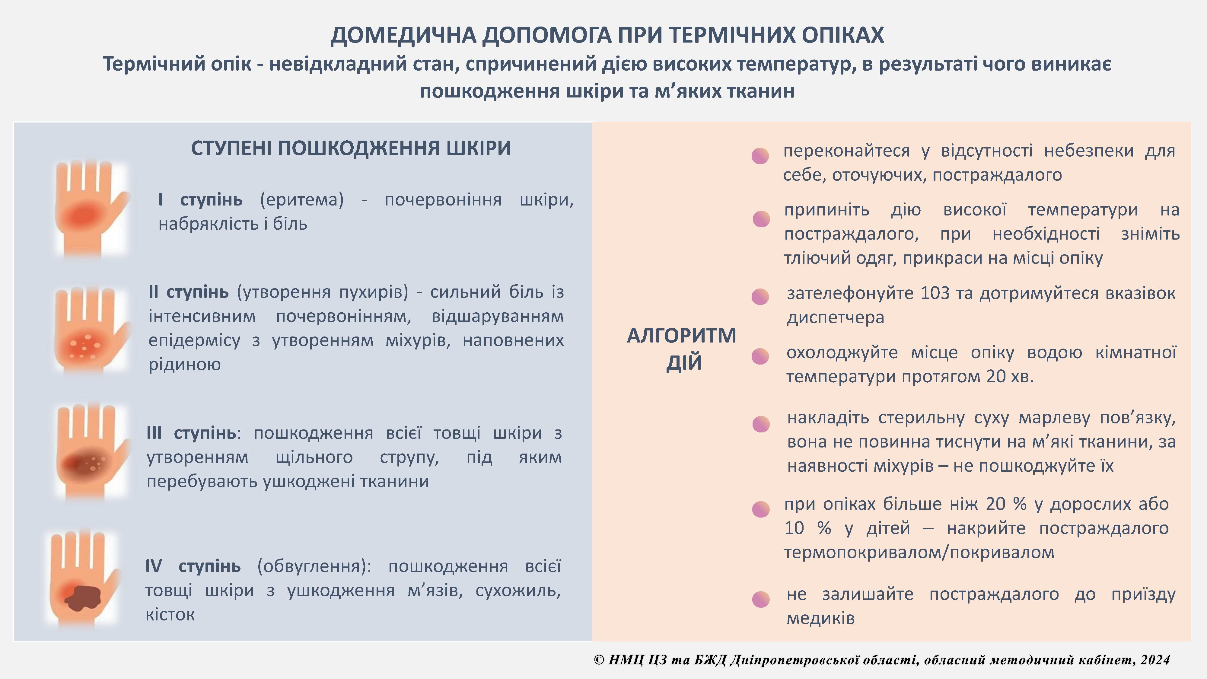 Медична допомога при термічних опіках
